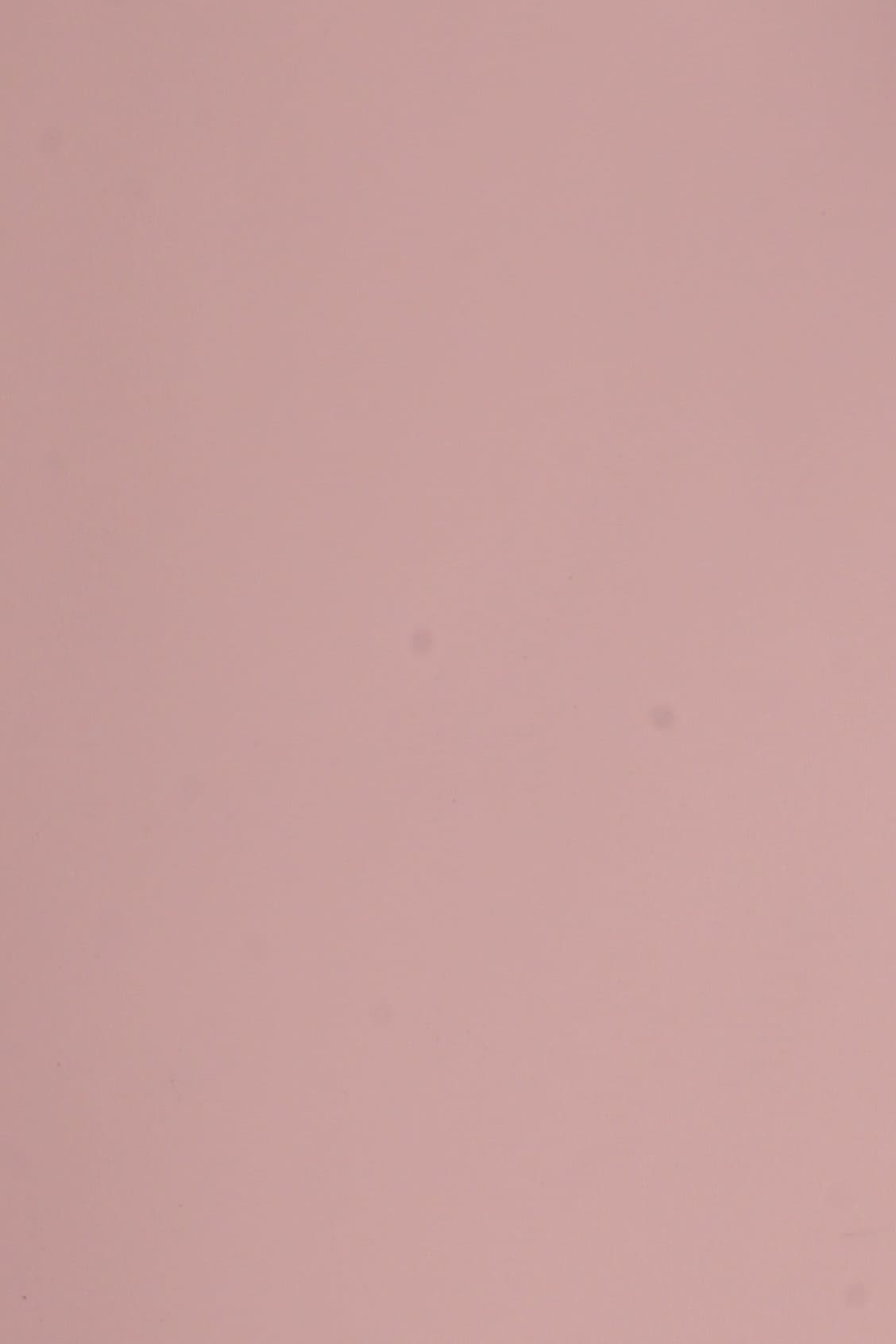 Dana Supozulato Pembe