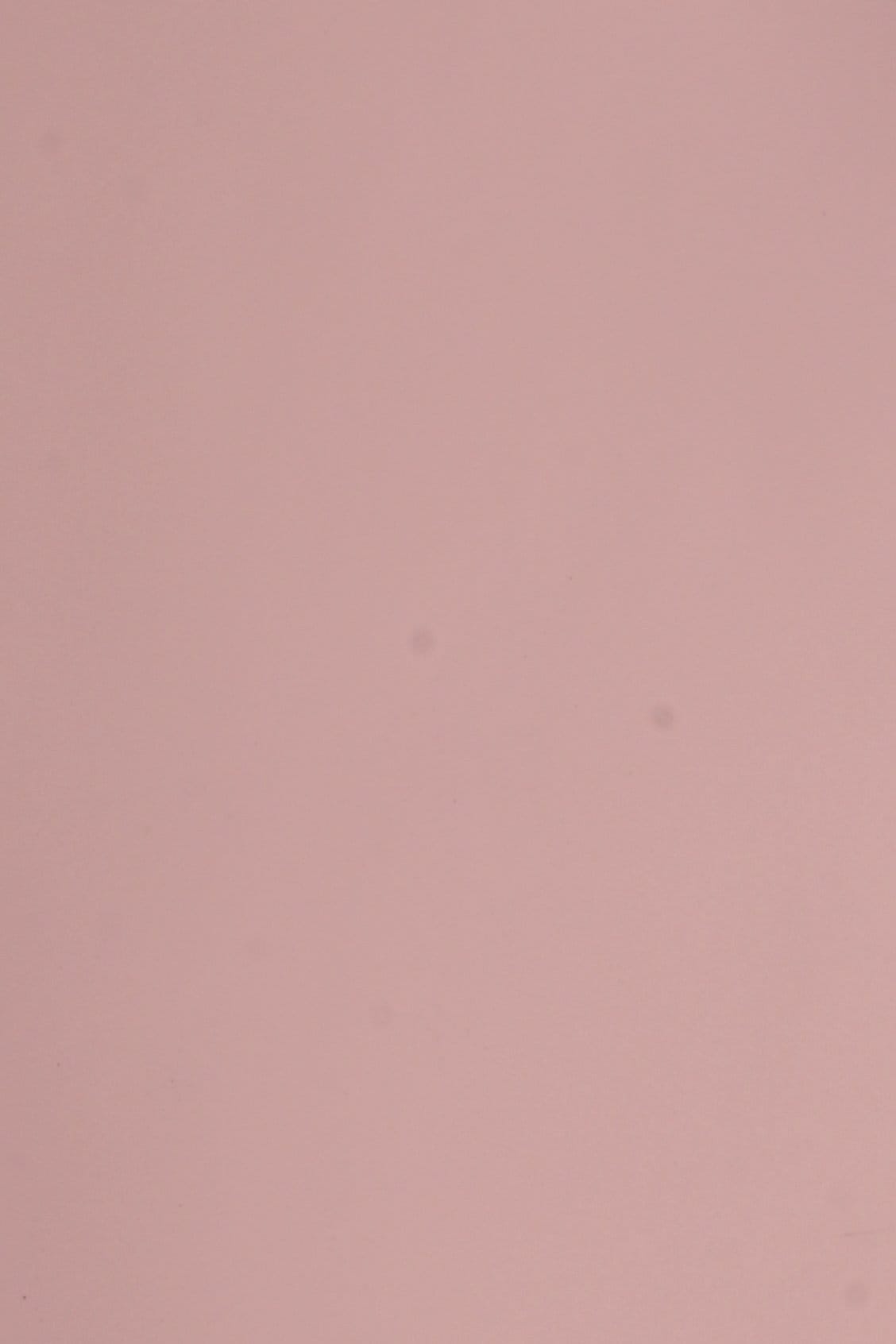 Dana Supozulato Pembe - 1